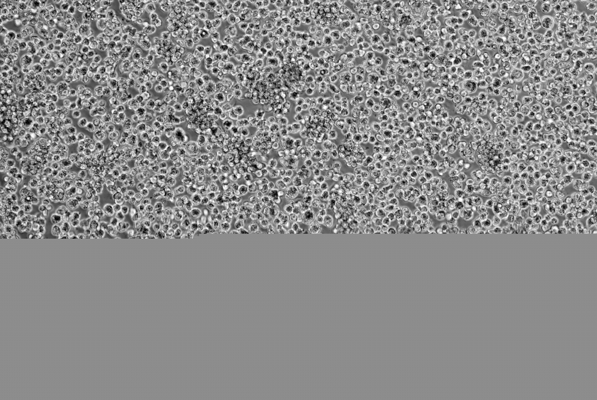 人單核細胞白血病(THP-1)